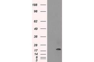 Image no. 1 for anti-Crystallin, alpha B (CRYAB) antibody (ABIN1497644) (CRYAB Antikörper)