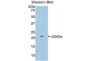 Detection of Recombinant IL1a, Human using Polyclonal Antibody to Interleukin 1 Alpha (IL1a) (IL1A Antikörper  (AA 95-269))