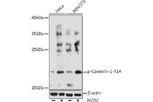 Western blot analysis of extracts of various cell lines, using Phospho-Caveolin-1-Y14 Rabbit pAb (ABIN6135195, ABIN6136032, ABIN6136033 and ABIN6225647) at 1:1000 dilution. (Caveolin-1 Antikörper  (pTyr14))