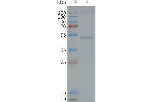 Human GRPR-Nanodisc, Flag Tag on SDS-PAGE (GRPR Protein)