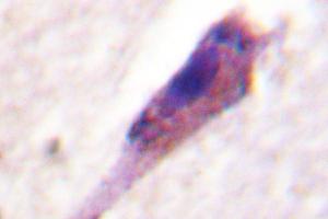 Image no. 1 for anti-Arrestin, beta 1 (ARRB1) antibody (ABIN271995) (beta Arrestin 1 Antikörper)