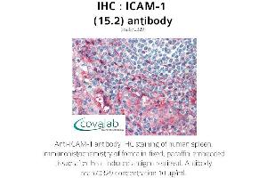 Image no. 2 for anti-Intercellular Adhesion Molecule 1 (ICAM1) antibody (ABIN1723250) (ICAM1 Antikörper)