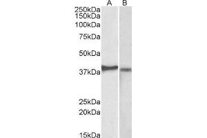 ABIN2562069 (2µg/ml) staining of Kelly (A) and U251-MG (B) lysates (35µg protein in RIPA buffer). (CX3CR1 Antikörper  (N-Term))