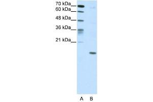 DUX5 antibody (20R-1209) used at 0. (DUX5 Antikörper  (C-Term))