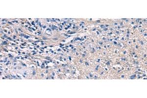 Immunohistochemistry of paraffin-embedded Human brain tissue using PROKR2 Polyclonal Antibody at dilution of 1:40(x200) (Prokineticin Receptor 2 Antikörper)