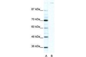 Western Blotting (WB) image for anti-Zinc Finger Protein GLI1 (GLI1) antibody (ABIN2460438) (GLI1 Antikörper)