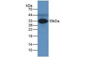 Detection of FCN3 in Human Serum using Polyclonal Antibody to Ficolin 3 (FCN3) (FCN3 Antikörper  (AA 34-297))