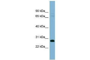WB Suggested Anti-TMEM176A Antibody Titration:  0. (TMEM176A Antikörper  (Middle Region))