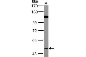 WB Image Sample (30 ug of whole cell lysate) A: A549 7. (BACE1 Antikörper)