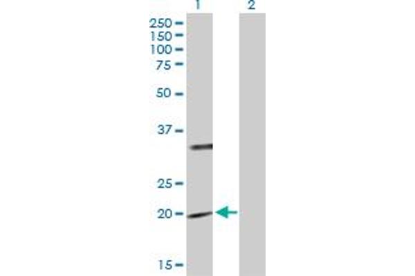 PTPMT1 Antikörper  (AA 1-201)