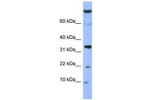 Image no. 1 for anti-Family with Sequence Similarity 178, Member B (FAM178B) (AA 607-656) antibody (ABIN6741667) (FAM178B Antikörper  (AA 607-656))