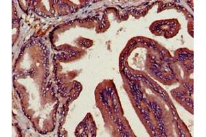 Immunohistochemistry of paraffin-embedded human prostate tissue using ABIN7149984 at dilution of 1:100 (DPP4 Antikörper  (AA 473-588))