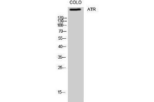 Western Blotting (WB) image for anti-ATR serine/threonine kinase (ATR) (Ser16) antibody (ABIN3173961) (ATR Antikörper  (Ser16))