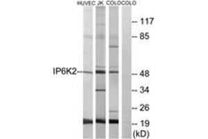 Western blot analysis of extracts from HuvEc/COLO/Jurkat cells, using IP6K2 Antibody. (IP6K2 Antikörper  (AA 161-210))
