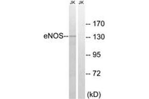 Western Blotting (WB) image for anti-Nitric Oxide Synthase 3 (Endothelial Cell) (NOS3) (AA 1144-1193) antibody (ABIN2888981) (ENOS Antikörper  (AA 1144-1193))