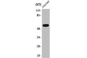Western Blot analysis of COLO205 cells using Phospho-Akt (T308) Polyclonal Antibody (AKT 1/2/3 Antikörper  (pThr308))