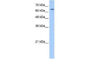 WB Suggested Anti-SLC22A11 Antibody Titration:  1. (SLC22A11 Antikörper  (N-Term))