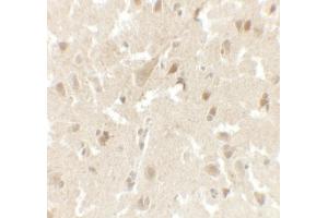 Immunohistochemistry (IHC) image for anti-LIM Homeobox Transcription Factor 1, beta (LMX1B) (C-Term) antibody (ABIN1077396) (LMX1B Antikörper  (C-Term))