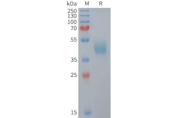 CCR6 Protein (AA 1-39) (Fc Tag)