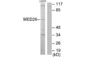 Western Blotting (WB) image for anti-Mediator Complex Subunit 26 (MED26) (N-Term) antibody (ABIN1849071) (MED26 Antikörper  (N-Term))