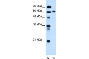 Western Blotting (WB) image for anti-Inositol 1,4,5-Triphosphate Receptor Interacting Protein-Like 1 (ITPRIPL1) antibody (ABIN2463966) (ITPRIPL1 Antikörper)