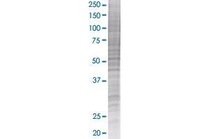 ST8SIA2 transfected lysate. (ST8SIA2 293T Cell Transient Overexpression Lysate(Denatured))