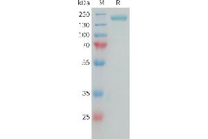 Human C(1538-2221) Protein, hFc Tag on SDS-PAGE under reducing condition. (NG2 Protein (AA 1538-2221) (Fc Tag))