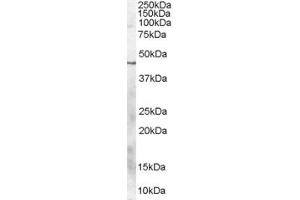 Western Blotting (WB) image for anti-Chromosome 20 Open Reading Frame 195 (C20orf195) (C-Term) antibody (ABIN2785564) (C20orf195 Antikörper  (C-Term))