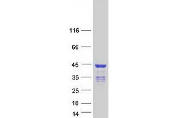 HNRNPC Protein (Transcript Variant 3) (Myc-DYKDDDDK Tag)