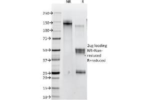 SDS-PAGE Analysis of Purified Catenin, beta Mouse Monoclonal Antibody (12F7). (CTNNB1 Antikörper  (N-Term))