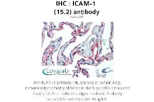 Image no. 1 for anti-Intercellular Adhesion Molecule 1 (ICAM1) antibody (ABIN1723250) (ICAM1 Antikörper)