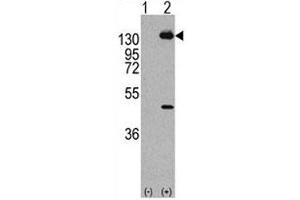 Western blot analysis of PDGFRA antibody and293 cell lysate (2 ug/lane) either nontransfected (Lane 1) or transiently transfected with the human gene (2). (PDGFRA Antikörper  (AA 746-775))