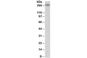 Western blot testing of Jurkat lysate with MYO5A antibody at 1ug/ml. (MYO5A Antikörper)