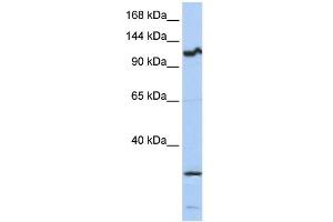WB Suggested Anti-OSMR Antibody Titration:  0. (Oncostatin M Receptor Antikörper  (Middle Region))