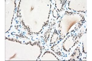 Immunohistochemical staining of paraffin-embedded Human Kidney tissue using anti-USP5 mouse monoclonal antibody. (USP5 Antikörper)