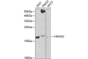 Western blot analysis of extracts of various cell lines, using HMGN2 antibody  at 1:1000 dilution. (HMGN2 Antikörper  (AA 1-90))