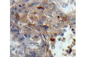 IHC-P analysis of Lung tissue, with DAB staining. (PKC theta Antikörper  (AA 380-634))