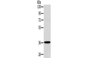 Western Blotting (WB) image for anti-PDZ and LIM Domain 1 (PDLIM1) antibody (ABIN2423957) (PDLIM1 Antikörper)