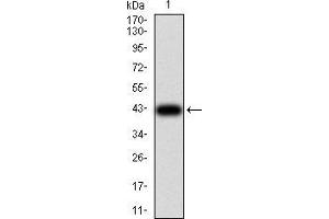 Western blot analysis using GFPT1 mAb against human GFPT1 (AA: 536-681) recombinant protein. (GFPT1 Antikörper  (AA 536-681))