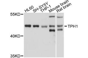 Western blot analysis of extracts of various cell lines, using TPH1 antibody (ABIN1875176) at 1:1000 dilution. (Tryptophan Hydroxylase 1 Antikörper)