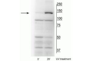 Western blot of HeLa cell lysates that had been treated with UV (~254 nm) for 0’ or 20’ showing specific immunolabeling of the ~150 kDa FANCI protein phosphorylated at Ser559. (FANCI Antikörper  (pSer556))