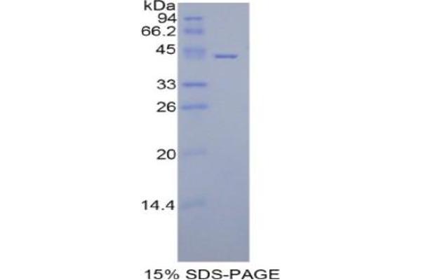 HIST1H2AA Protein