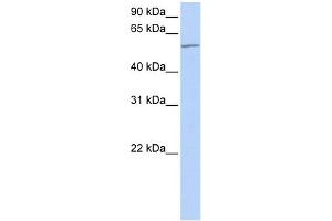 WB Suggested Anti-MTA3 Antibody Titration:  0. (MTA3 Antikörper  (C-Term))