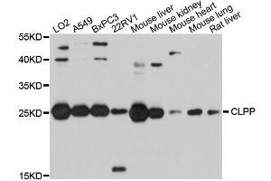Western blot analysis of extracts of various cell lines, using CLPP antibody (ABIN5995818) at 1/1000 dilution. (CLPP Antikörper)