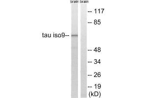Western Blotting (WB) image for anti-tau Protein (Thr217), (Thr534) antibody (ABIN1848202) (tau Antikörper  (Thr217, Thr534))