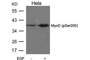 Western blot analysis of extracts from Hela cells untreated or treated with EGF using MyoD(Phospho-Ser200) Antibody. (MYOD1 Antikörper  (pSer200))