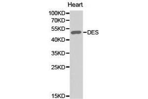 Western Blotting (WB) image for anti-Desmin (DES) antibody (ABIN1872252) (Desmin Antikörper)