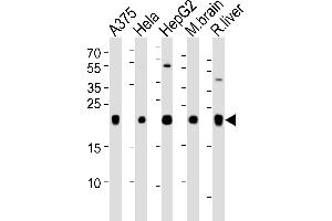 Western blot analysis of lysates from , Hela, HepG2 cell line, mouse brain and rat liver tissue lysate(from left to right), using IT Antibody (N-term) (ABIN651135 and ABIN2840091). (ITPA Antikörper  (N-Term))