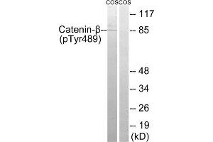 Western blot analysis of extracts from COS cells, treated with UV (15mins), using Catenin- beta (Phospho-Tyr489) antibody. (beta Catenin Antikörper  (pTyr489))