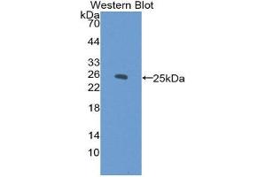 Western Blotting (WB) image for anti-Cardiac Troponin I (TNNI3) (AA 1-203) antibody (ABIN2116630) (TNNI3 Antikörper  (AA 1-203))